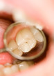 dental exam
