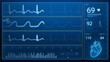 Video: Heart beat monitor - ecg concept in loop Heart beat monitor - ecg concept in loop
