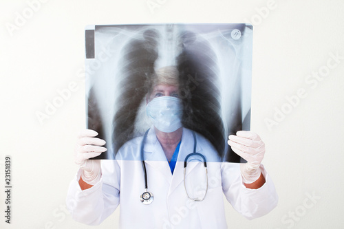Foto: doctor checking x-ray of chest doctor checking x-ray of chest
