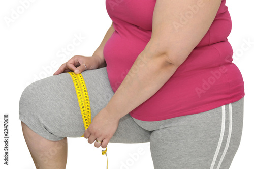 Photo: Obesity Obesity