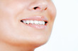 Foto: Teeth of a smiling young woman seen from the side Teeth of a smiling young woman seen from the side