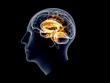 Xray Head with brain