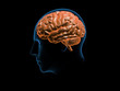 Brain solid side