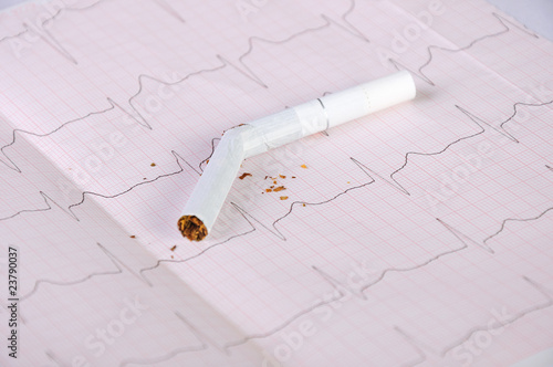 Photo: Cigarette and cardiogram Cigarette and cardiogram