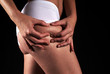 cellulite