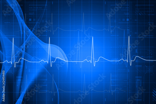 Illustration: ECG ECG