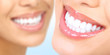 woman teeth