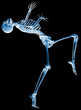 skeleton why me xray