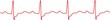 Heartbeat, heart monitor