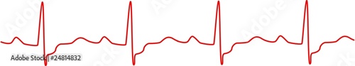 Vector: Heartbeat, heart monitor Heartbeat, heart monitor