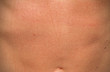 Photo: human skin human skin