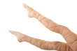 Legs pain concept