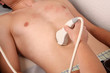 Sonographie