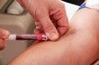 Blut abnehmen Blut abnehmen