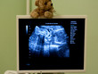 Geburtshelfer Prüfung schwangeren Bauch durch Ultraschall-Scan.