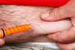 Insulin injection