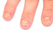 nail sick nail sick