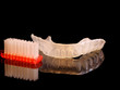 Photo: Knirschschiene/Zahnschiene/Aufbissschiene Knirschschiene/Zahnschiene/Aufbissschiene