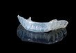 Photo: weiche Aufbisschiene/Knirschschiene weiche Aufbisschiene/Knirschschiene