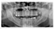 clinical checkup xray dental detail