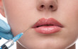 injection of botox to the face of beautiful woman injection of botox to the face of beautiful woman