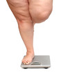 Foto: women legs with overweight women legs with overweight