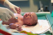 Newborn baby being examined by doctor