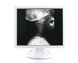 x-ray image and computer, concept modern medical diagnoses