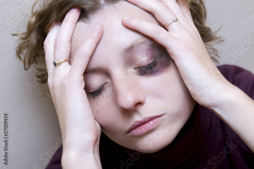 Photo: Victim of domestic violence Victim of domestic violence