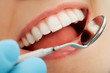 Foto: Mouth checkup Mouth checkup
