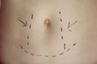 Women Marked for Cosmetic Surgery Women Marked for Cosmetic Surgery