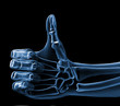 hand xray