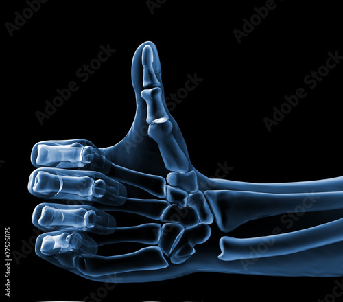 Illustration: hand xray hand xray