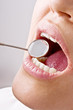 Close-up mouth examination by dentist. Close-up mouth examination by dentist.