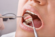 Close-up mouth examination by dentist. Close-up mouth examination by dentist.