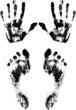 Palms and feet