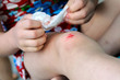Photo en ligne au meilleur prix Knee scratch