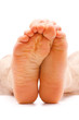 Cold feet