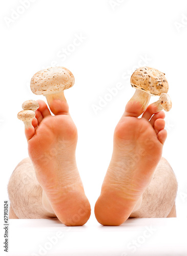 Photo: Toe nail and skin fungus Toe nail and skin fungus