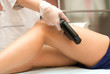 Laser epilation