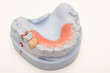 Gebiss - Mandible model