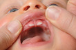 Baby bekommt erste Zähne 3