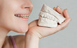 Smile with bracket & plaster jaw model
