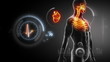 Video: Human heart x-ray scan Human heart x-ray scan