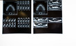 radiografia denti