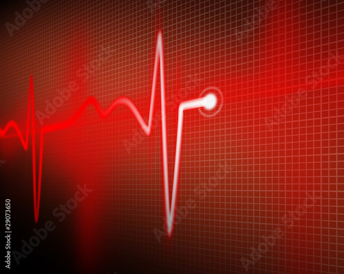 Photo: cardiogram cardiogram