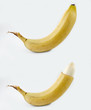 Circumcision - before and after Circumcision - before and after