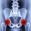 pelvis