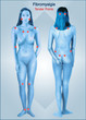 Fibromyalgie. Dauerschmerz Fibromyalgie. Dauerschmerz