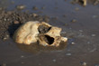 Human skull